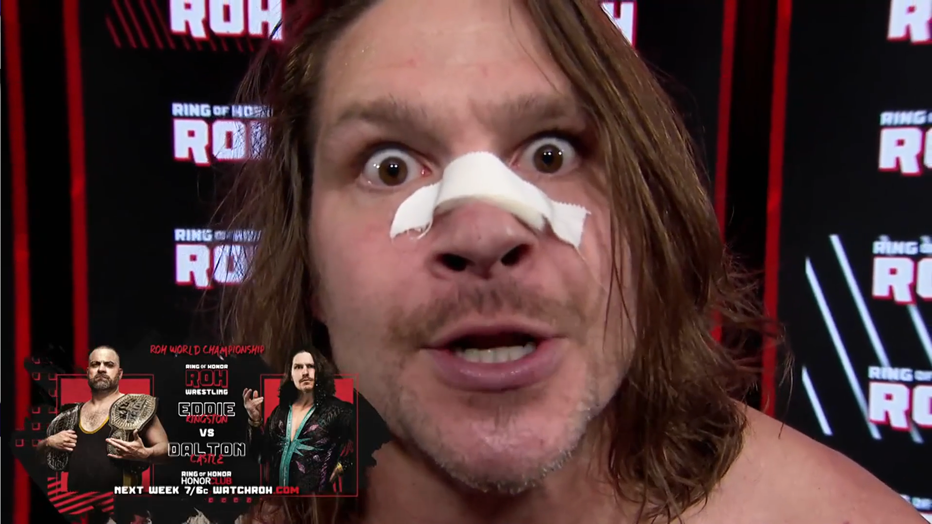 Dalton Castle Isn't Scared To Smash His Nose For Some Fondue, Will Face