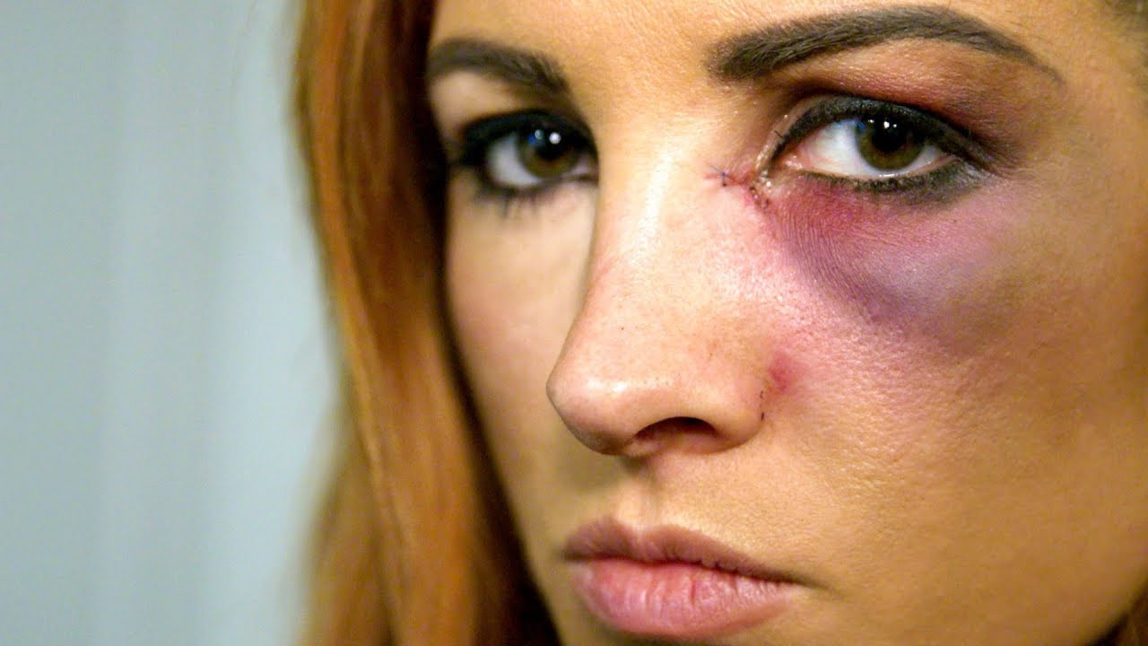 WWE's Becky Lynch Claps Back At Ronda Rousey On Twitter